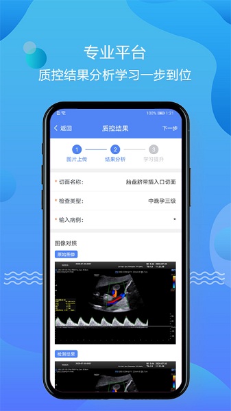 超声智库手机版