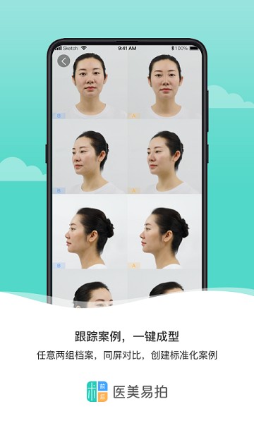 医美易拍软件