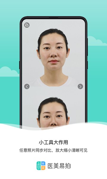 医美易拍软件