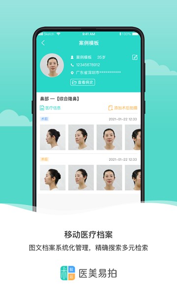医美易拍软件