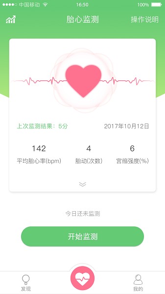 喜芽胎心监护