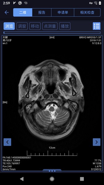 东软睿影最新版